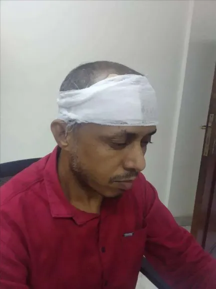 ”اعتداءٌ بالحديد على صحفي في قلب عدن.. من يكون الجاني؟”